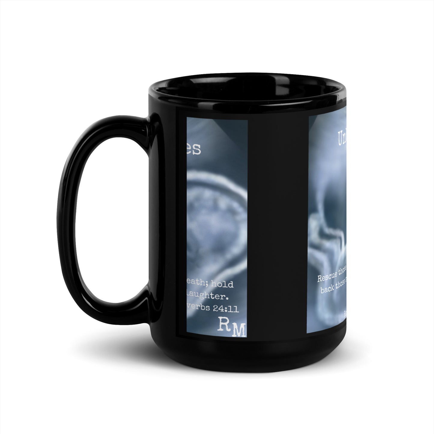 Unborn Lives Matter Black Glossy Mug