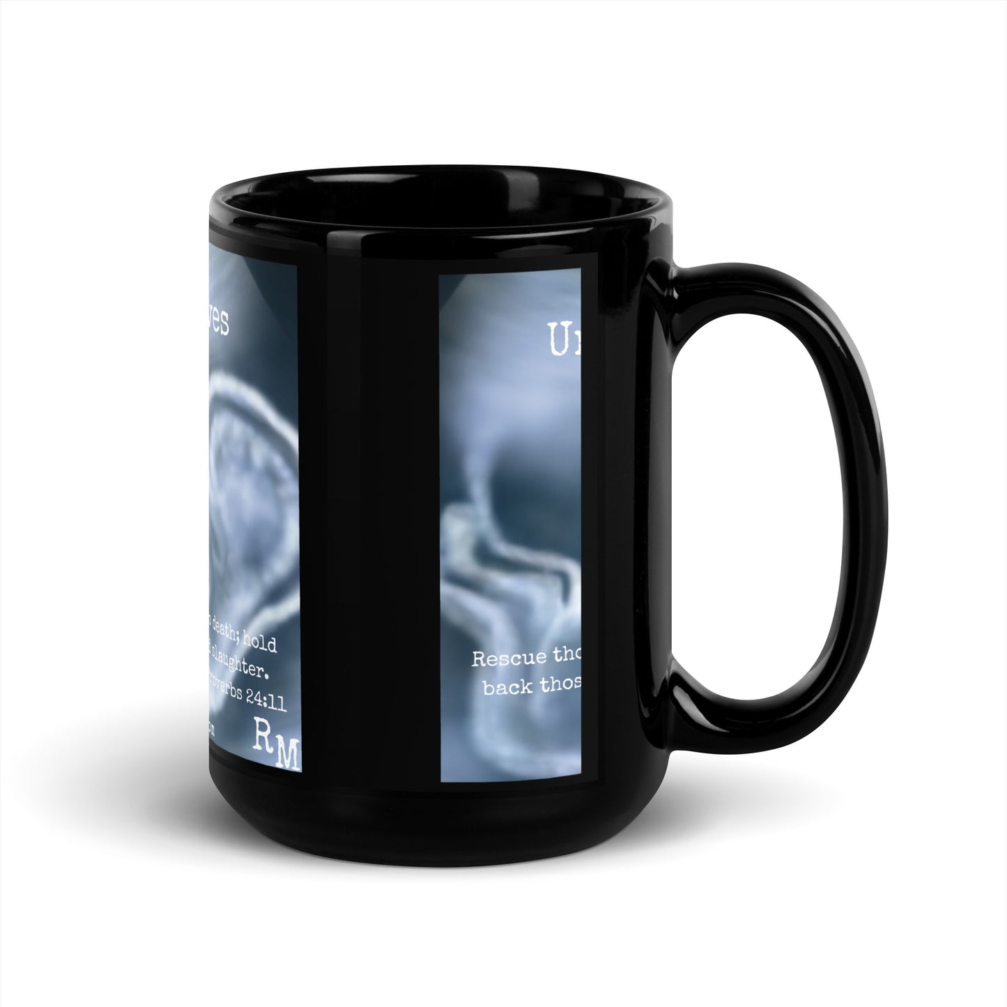 Unborn Lives Matter Black Glossy Mug